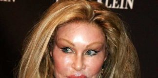 Estetik Operasyonlarına Servet Harcayan 5 Ünlü Estetik